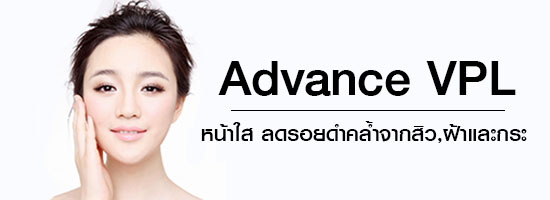 Advance VPL