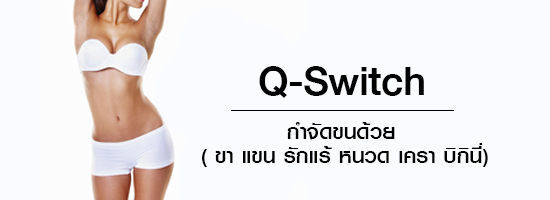 Q-Switch